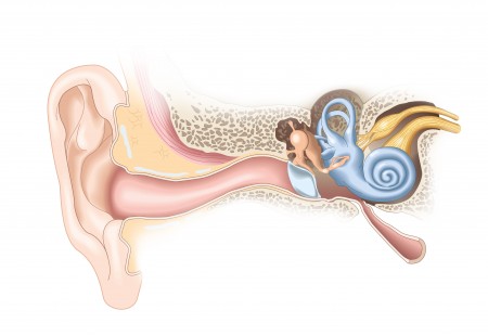 Mixed Hearing Loss